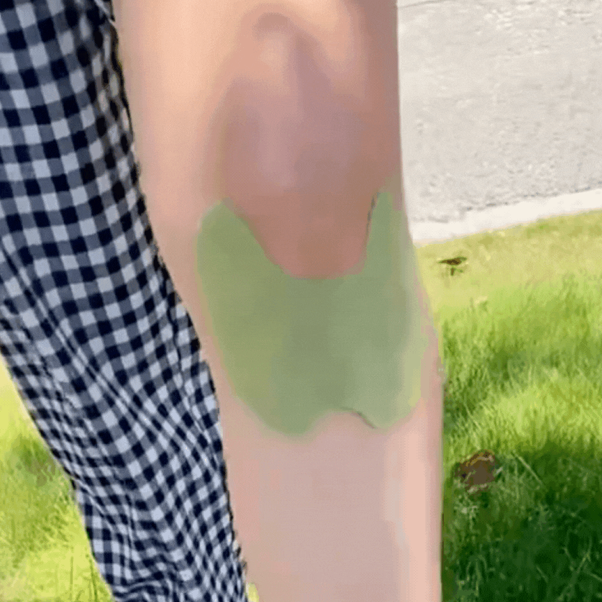 NexoPro: Parches de Alivio del Dolor de Rodilla 12 piezas - NEXO SHOP